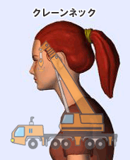 �N���[���l�b�N