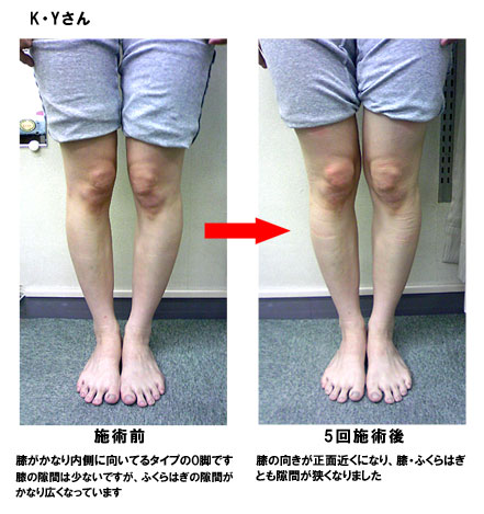 O�r�����r�t�H�[�E�A�t�^�[