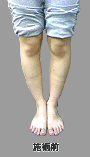 ����ɂ��O�r�̕ω�